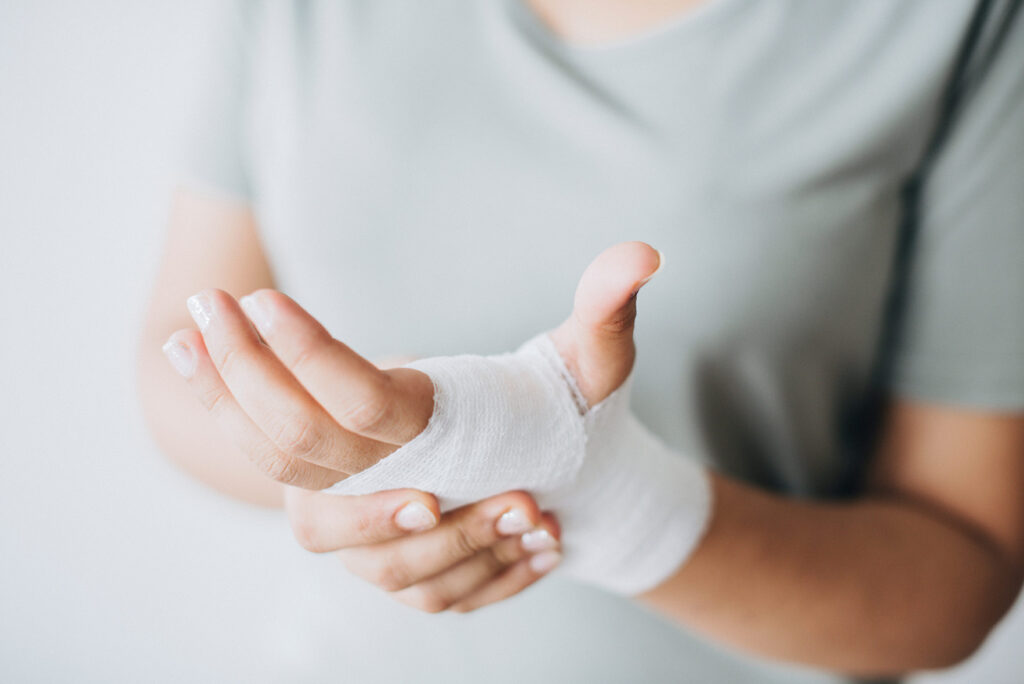 A closeup image of a hand wrapped in gauze after sustaining an injury.